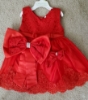 Picture of Set of 2 baby frock